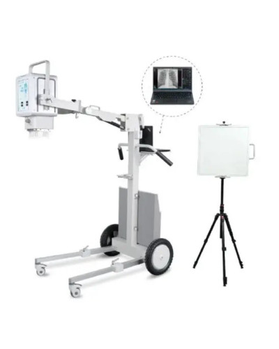 Appareil de radiographie portable numérique 5,6 kW, modèle YSX056-PE