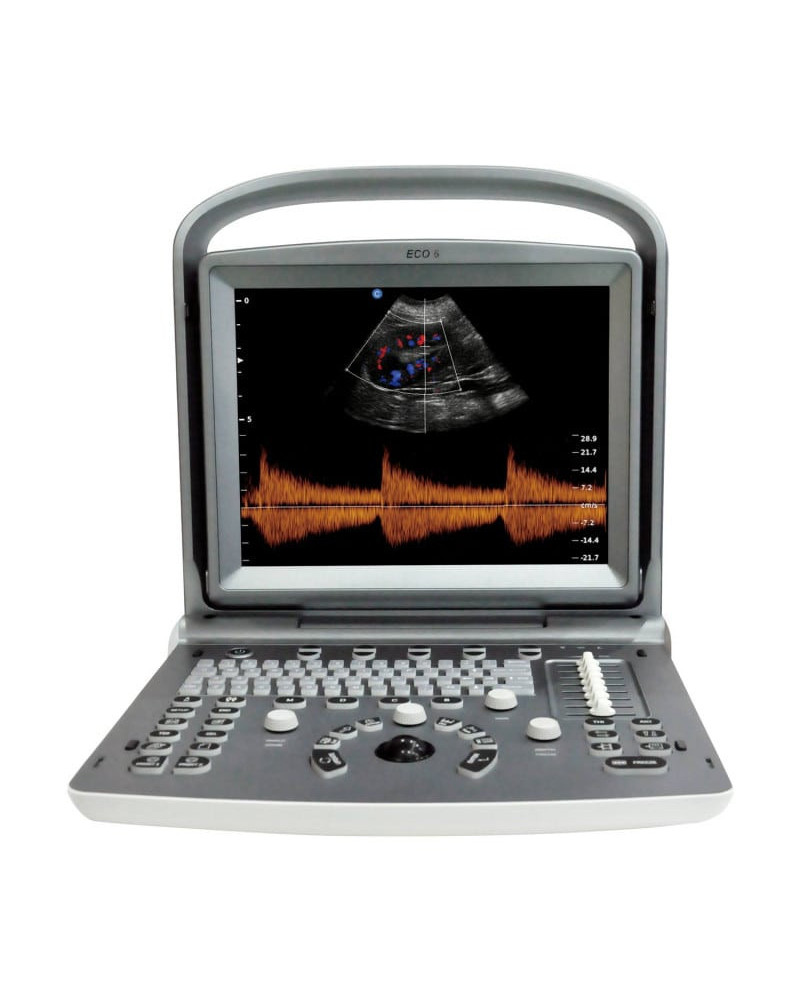 Appareil ultrasons pour échographie modèle CHISON ECO 6 avec doppler couleur