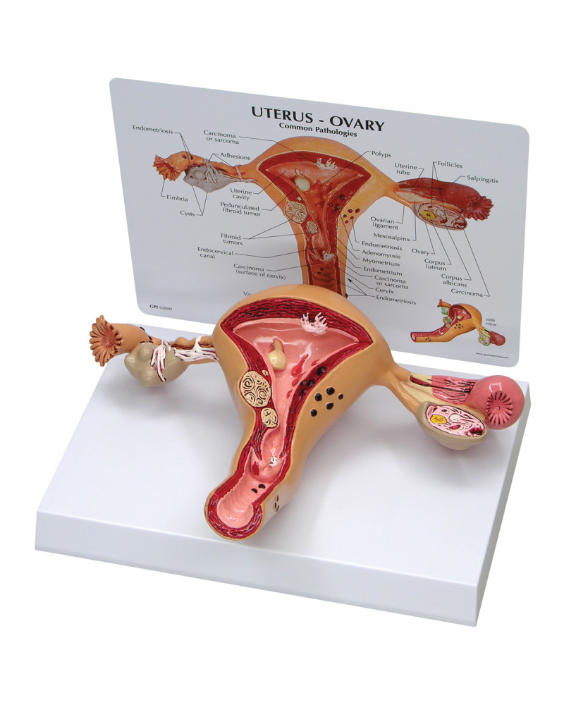 Modèle Anatomique De L\'Utérus Ovaire