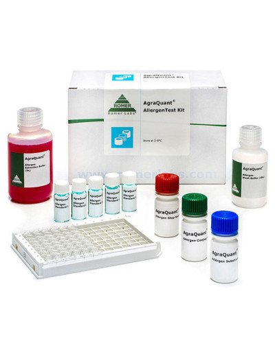 Kit protéines sériques (bandelettes pour 4 échantillons) 100 tests