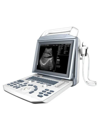 Système d'échographie numérique N/B portable i50