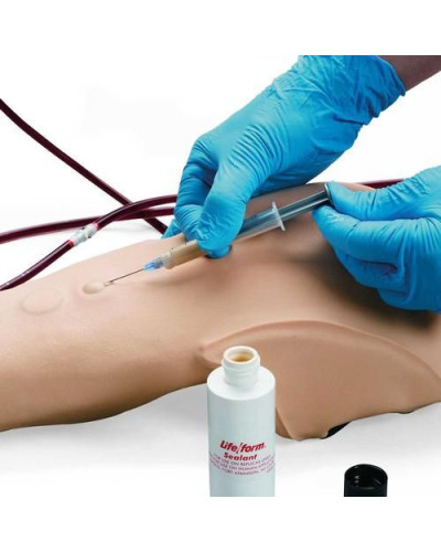 Bras d\'injection et intraveineux multi-veineux, peau claire