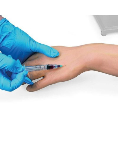 Bras d\'injection et intraveineux multi-veineux, peau claire