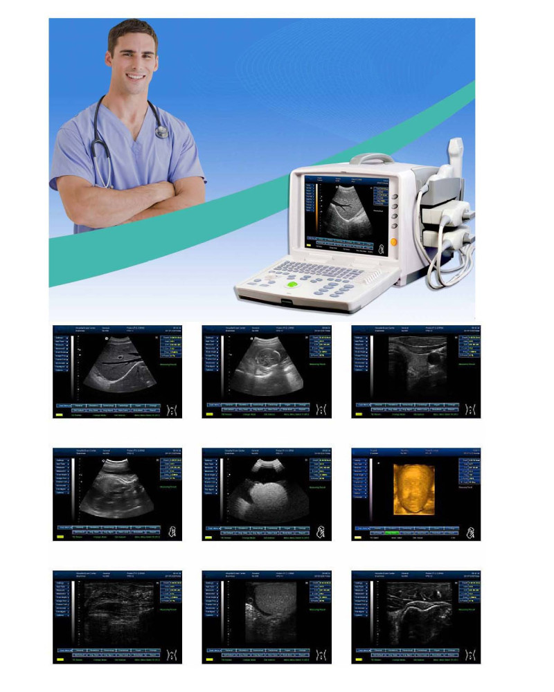 Echographe portable Noir/Blanc PROMED DP-5