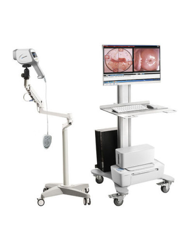 Colposcope vidéo HD modèle KN-2200A