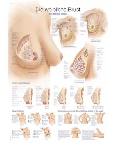 Graphique du Sein , 70 x 100cm