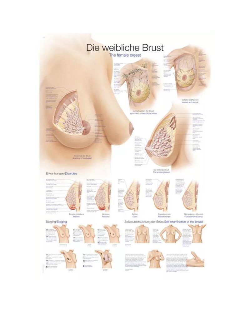 Graphique du Sein , 70 x 100cm
