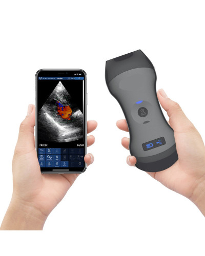 Echographe Doppler portable sans fil