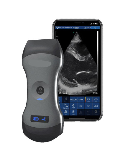 Echographe Doppler portable sans fil