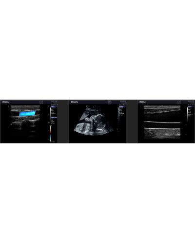 Echographe portable couleur ACCLARIX AX2