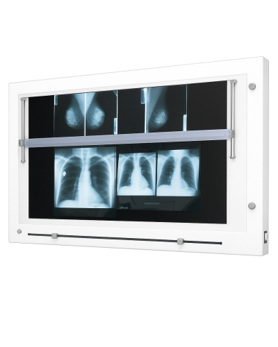 Négatoscope pour mammographie, 1 X 108 X 60 Cm