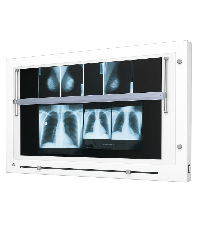 Négatoscope pour mammographie, 1 X 108 X 60 Cm