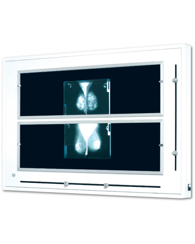 Négatoscope pour mammographie, 1 X 108 X 60 Cm