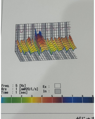 Appareil de ponction pulmonaire-MostGraph-02