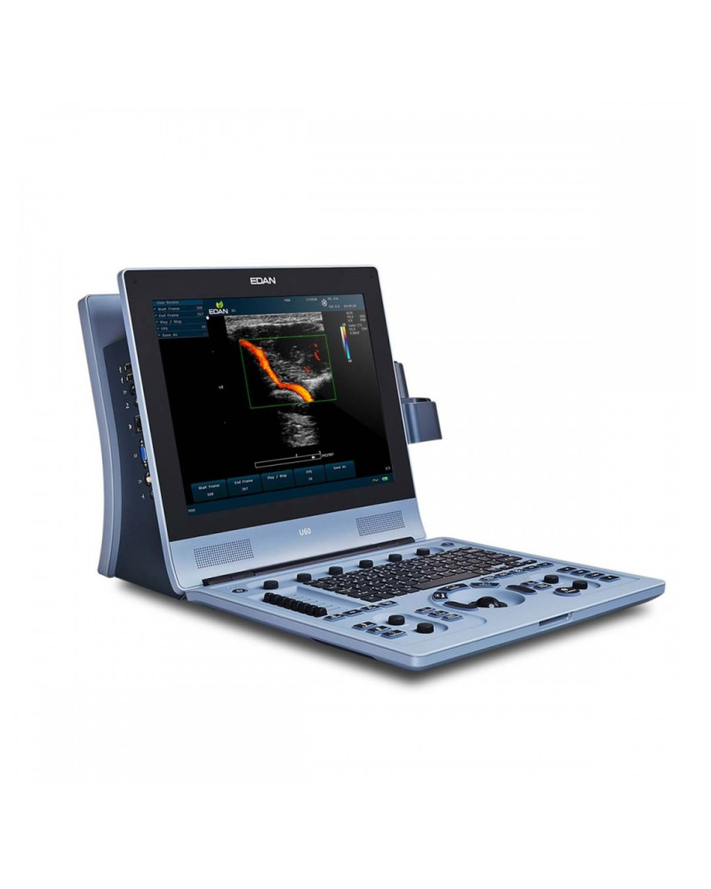 Échographe portable EDAN U60 avec doppler couleur