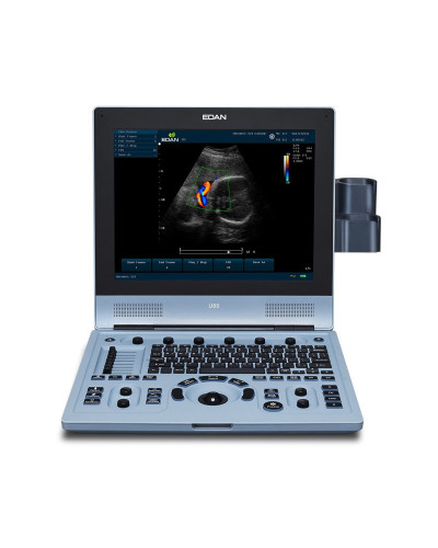 Échographe portable EDAN U60 avec doppler couleur