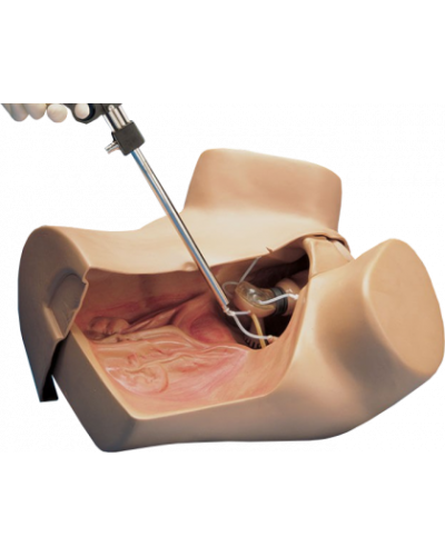 Mannequin de gynécologie