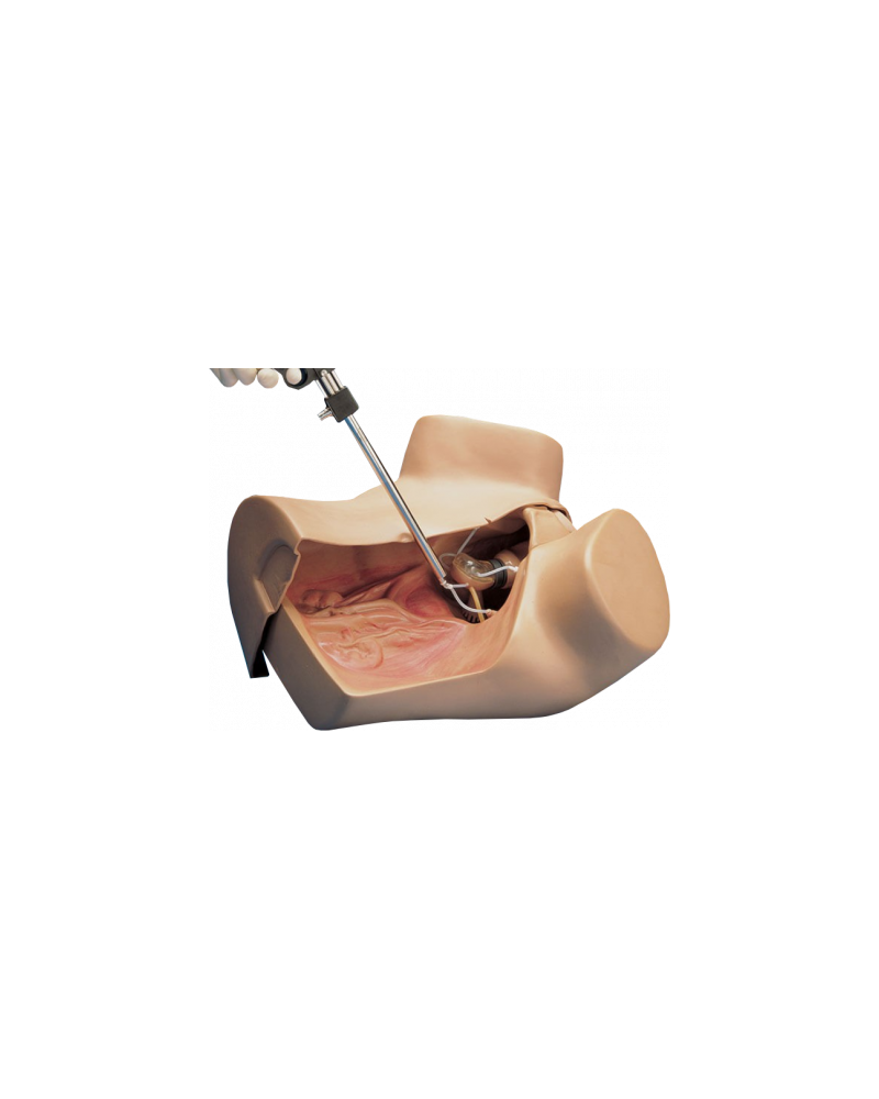 Mannequin de gynécologie