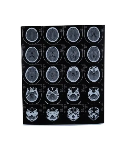 Film d'imagerie médicale HQ-KX410 Film d'imagerie médicale HQ-KX410