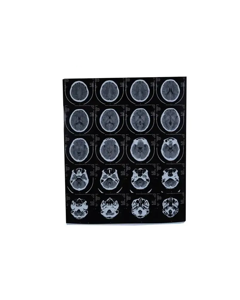 Film d'imagerie médicale HQ-KX410 Film d'imagerie médicale HQ-KX410