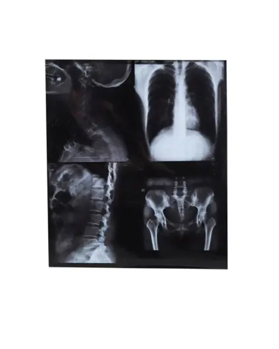 Film d'imagerie médicale HQ-KX410 Film d'imagerie médicale HQ-KX410