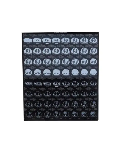 Film d'imagerie médicale HQ-KX410 Film d'imagerie médicale HQ-KX410