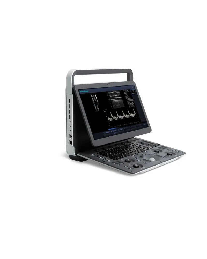Echographe portable noir/blanc E1