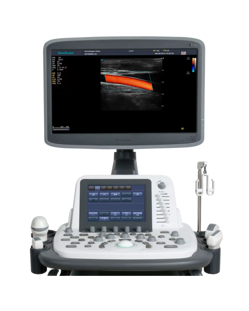 Échographe Doppler couleur sur chariot modèle S22