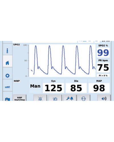 Moniteur amagnétique tesla duo NIBP pression artérielle automatique