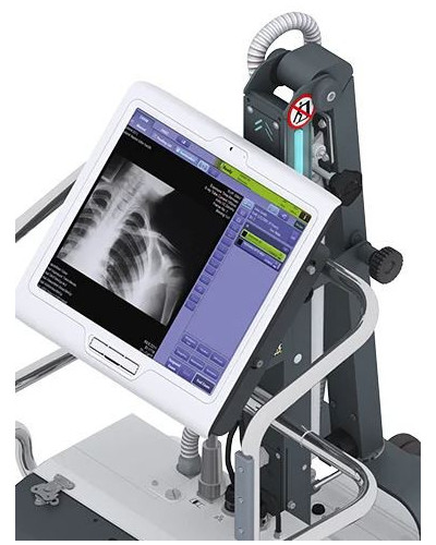 Appareil mobile de radiologie numérisé par capteur plan, avec batterie, MOVIX SERIE DREAM