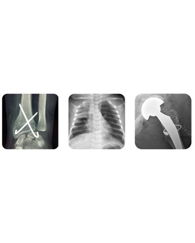 Appareil mobile de radiologie numérisé par capteur plan, avec batterie, MOVIX SERIE DREAM