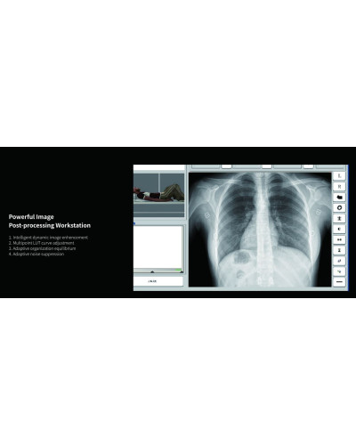 Appareil de radiographie numérique ASR-6150C (F) monté sur sol