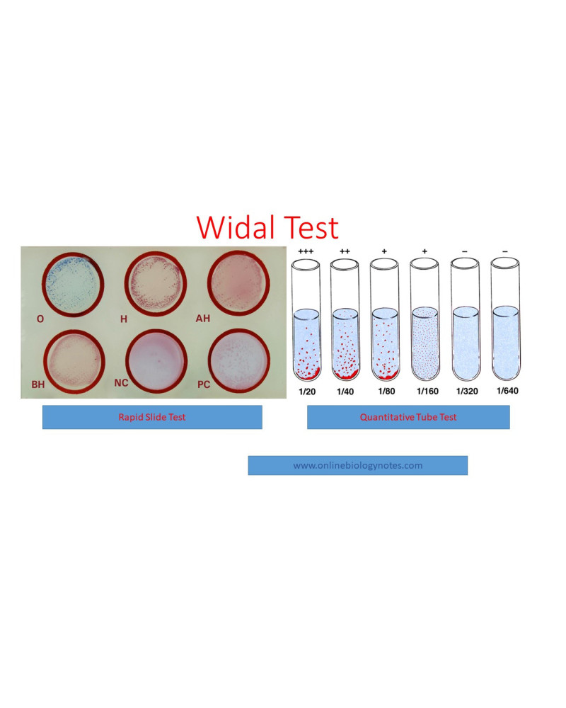 Réactif test de widal Felix
