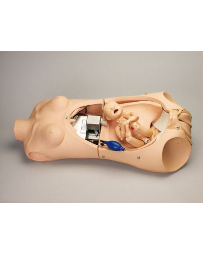 Torse d'Accouchement