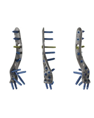 Plaque fémorale proximale, 4.5mm, acier inox 9 trous SURGIVAL