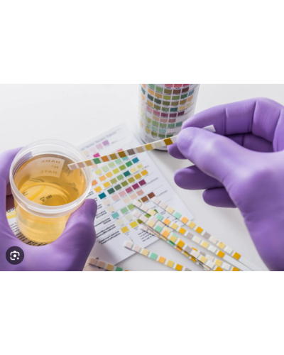 Bandelette BA-11A pour analyseur d'urine BA600