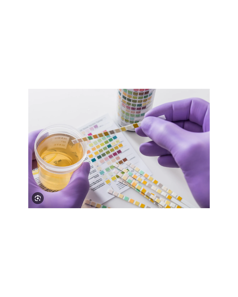 Bandelette BA-11A pour analyseur d'urine BA600