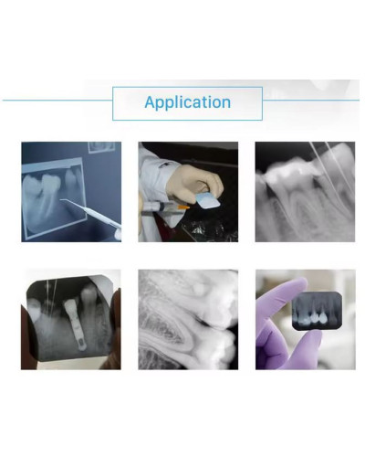 Chambre Noire Manuelle Pour Radio Dentaire