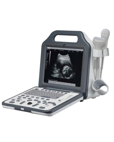 Echographe numérique portable noir et blanc, Modèle N5