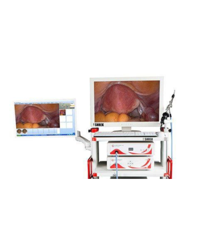 Colonne d'endoscopie pour coelioscopie ou laparoscopie modèle SOC-SHREK