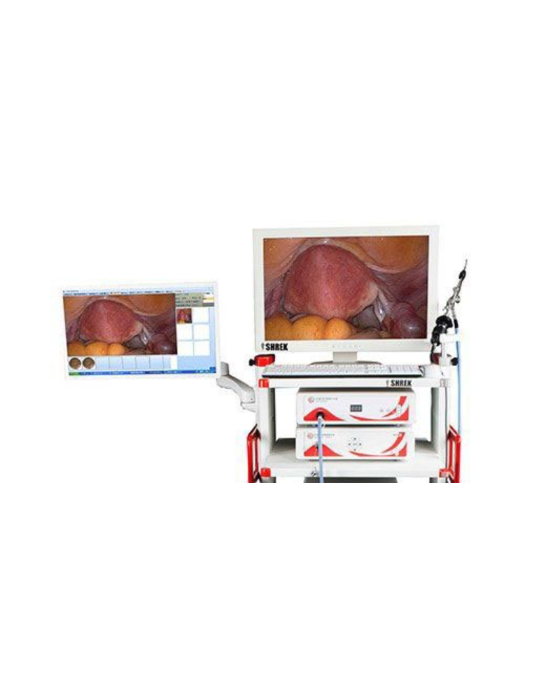 Colonne d'endoscopie pour coelioscopie ou laparoscopie modèle SOC-SHREK