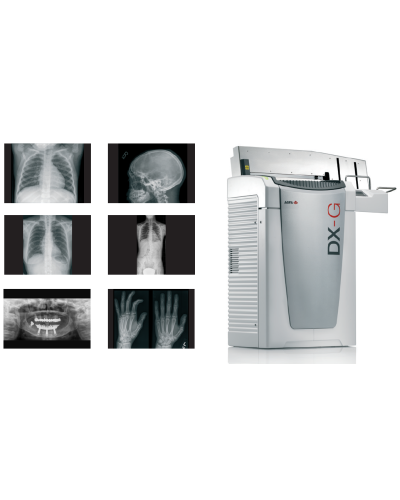 Système de numérisation DX-G