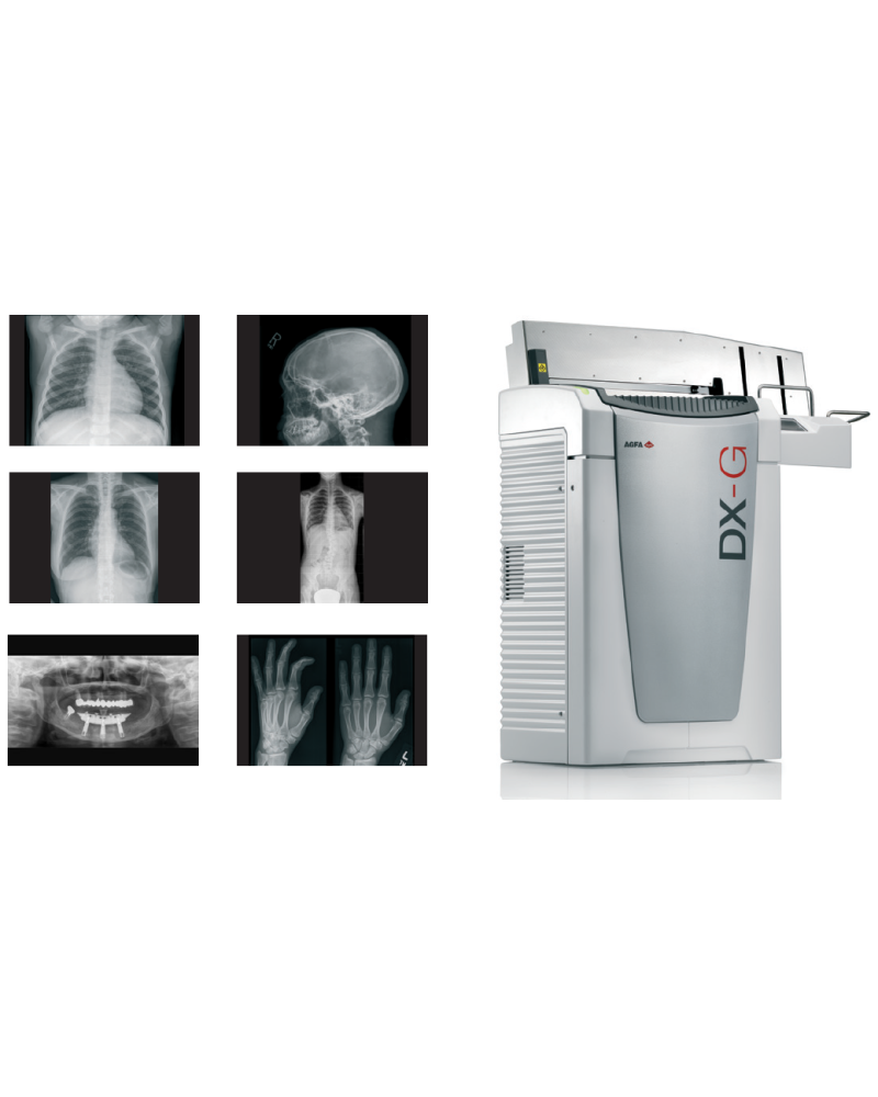 Système de numérisation DX-G