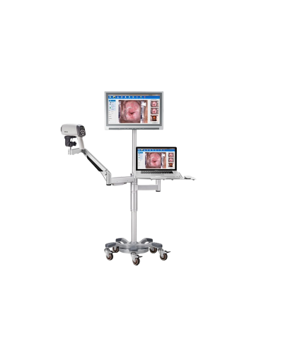 Colposcope vidéo ED-C6HD avec bras  mobile en T