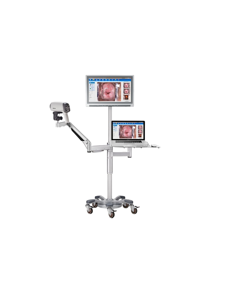 Colposcope vidéo ED-C6HD avec bras  mobile en T