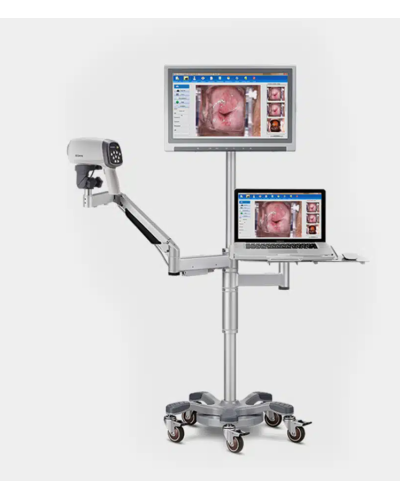 Colposcope vidéo ED-C6HD avec bras  mobile en T