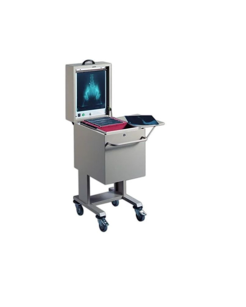 Chariot de rangement des radios avec negatoscope