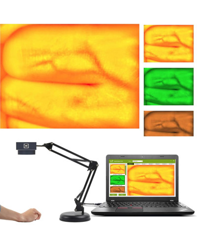 Lampe mobile pour voie veineuse - Détecteur de veine, pour Adulte et Enfants