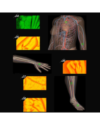 Lampe mobile pour voie veineuse - Détecteur de veine, pour Adulte et Enfants