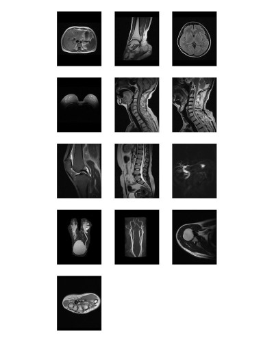 Appareil de radiographie Mindray, Modèle MagSense 360